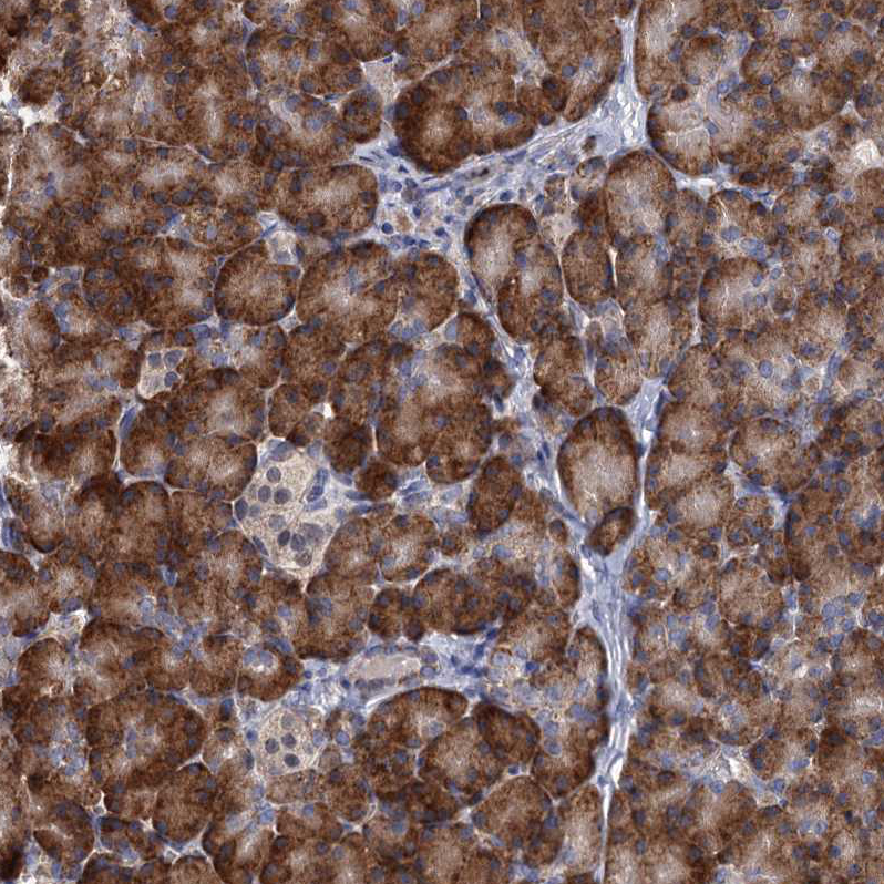 Anti-ALKBH7 Antibody