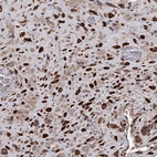 Immunohistochemical staining of human Placenta shows strong granular cytoplasmic positivity in decidual cells.