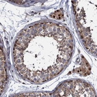 Immunohistochemical staining of human Testis shows moderate granular cytoplasmic positivity in cells in seminiferous ducts and Leydig cells.
