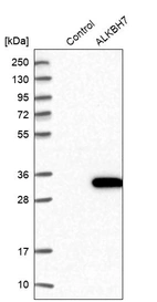 Western blot analysis in control (vector only transfected HEK293T lysate) and ALKBH7 over-expression lysate (Co-expressed with a C-terminal myc-DDK tag (~3.1 kDa) in mammalian HEK293T cells, LY403154).