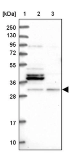 Lane 1: Marker [kDa] 250, 130, 95, 72, 55, 36, 28, 17, 10_br/_Lane 2: Human cell line RT-4_br/_Lane 3: Human cell line U-251MG sp