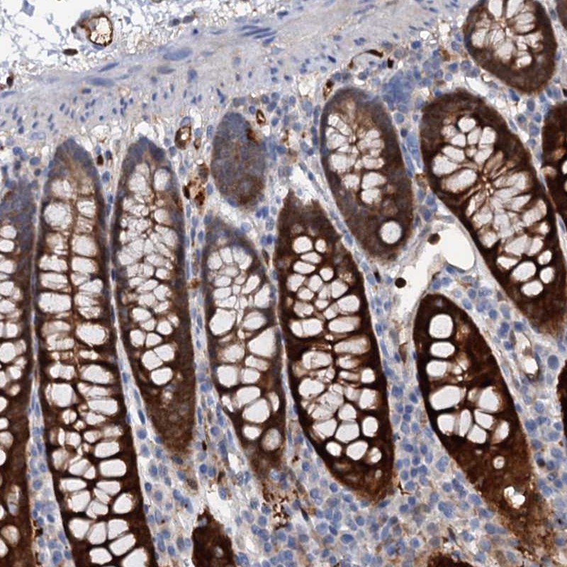 Anti-IL17RD Antibody