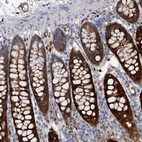 Anti-IL17RD Antibody