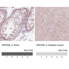Anti-SPATA6L Antibody