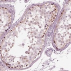 Immunohistochemical staining of human testis shows high expression.