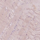 Immunohistochemical staining of human skeletal muscle shows low expression as expected.