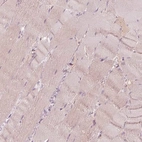 Immunohistochemical staining of human skeletal muscle shows low expression as expected.