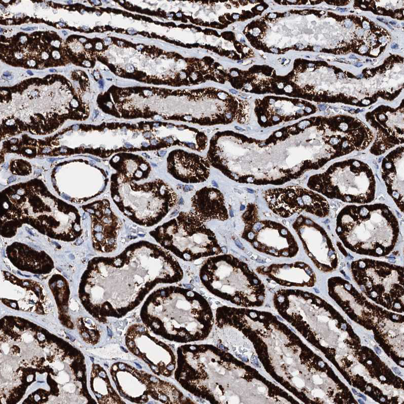 Anti-HADH Antibody