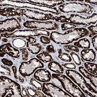 Anti-HADH Antibody