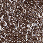 Immunohistochemical staining of human liver shows strong granular cytoplasmic positivity in hepatocytes.