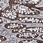 Immunohistochemical staining of human rectum shows strong granular cytoplasmic positivity in glandular cells.