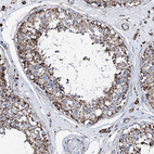 Immunohistochemical staining of human testis shows moderate granular cytoplasmic positivity in cells in seminiferous ducts.