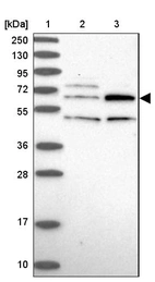 Lane 1: Marker [kDa] 250, 130, 95, 72, 55, 36, 28, 17, 10_br/_Lane 2: Human cell line RT-4_br/_Lane 3: Human cell line U-251MG sp