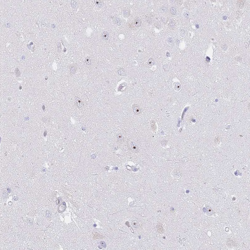 Anti-NOP14 Antibody