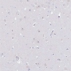 Anti-NOP14 Antibody