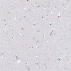 Anti-NOP14 Antibody