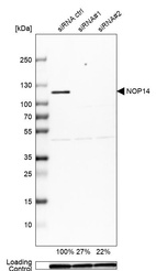 Western blot analysis in U-251MG cells transfected with control siRNA, target specific siRNA probe #1 and #2, using Anti-NOP14 antibody. Remaining relative intensity is presented. Loading control: Anti-GAPDH.