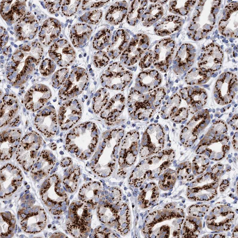 Anti-TM9SF3 Antibody