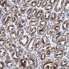 Anti-TM9SF3 Antibody