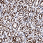 Anti-TM9SF3 Antibody