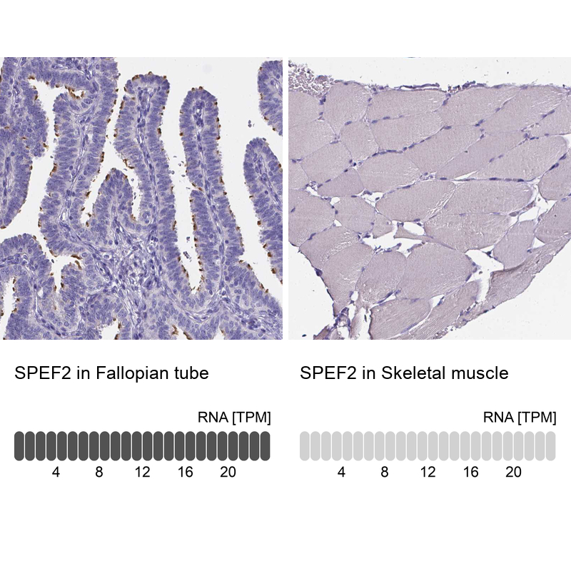 Anti-SPEF2 Antibody