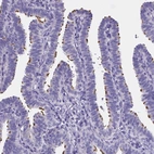 Immunohistochemical staining of human fallopian tube shows strong cytoplasmic positivity in cilia in glandular cells.