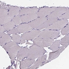 Immunohistochemical staining of human skeletal muscle shows no positivity in myocytes as expected.