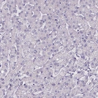 Immunohistochemical staining of human liver shows no positivity in hepatocytes as expected.