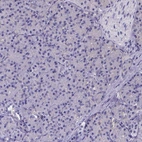 Immunohistochemical staining of human pancreas shows no positivity in exocrine glandular cells as expected.