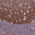 Anti-NCAPG Antibody