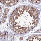 Immunohistochemical staining of human testis shows moderate cytoplasmic positivity in cells in seminiferous ducts.