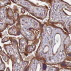 Immunohistochemical staining of human placenta shows strong cytoplasmic positivity in trophoblastic cells.