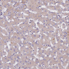 Anti-NCAPG Antibody