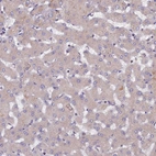 Immunohistochemical staining of human liver shows low positivity in hepatocytes asexpected.
