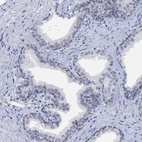 Immunohistochemical staining of human prostate shows moderate positivity in nucleoli in glandular cells.