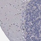 Immunohistochemical staining of human cerebellum shows moderate positivity in nucleoli in Purkinje cells and in cells in molecular layer.