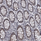 Immunohistochemical staining of human colon shows moderate positivity in nucleoli in glandular cells.