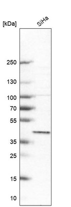 Western blot analysis in human cell line SiHa.