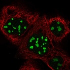Immunofluorescent staining of human cell line A-431 shows localization to nucleoli.