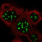 Immunofluorescent staining of human cell line A-431 shows localization to nucleoli.