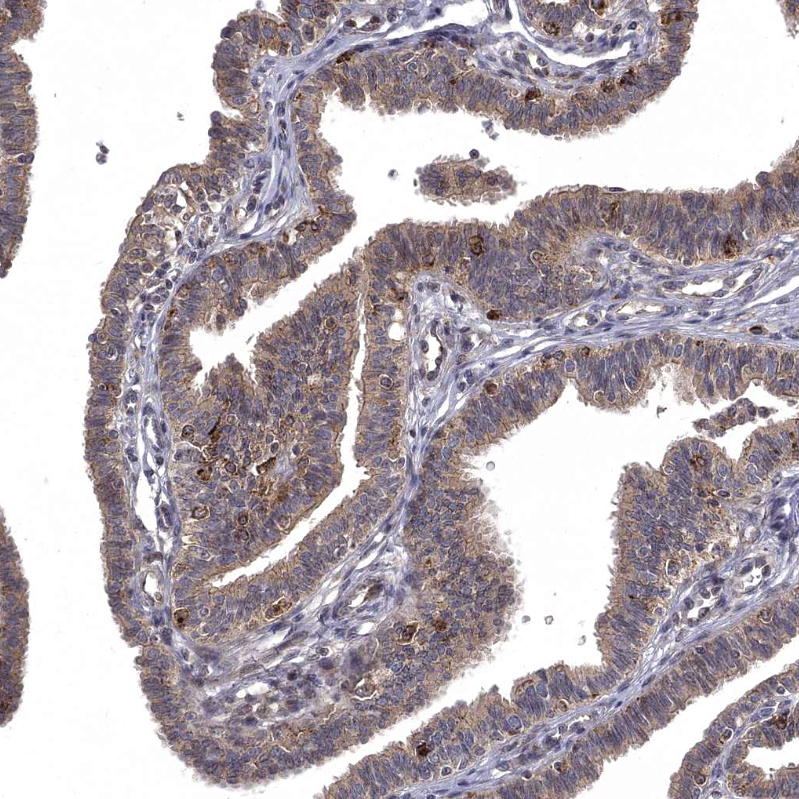 Anti-WDR19 Antibody