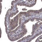 Anti-WDR19 Antibody