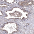 Immunohistochemical staining of human prostate shows moderate cytoplasmic positivity in glandular cells.