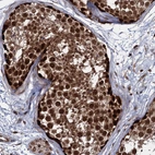 Anti-UBLCP1 Antibody