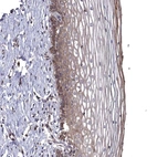 Immunohistochemical staining of human cervix, uterine shows moderate cytoplasmic positivity in squamous epithelial cells.