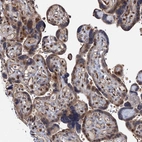 Immunohistochemical staining of human placenta shows moderate nuclear positivity in trophoblastic cells.