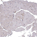 Immunohistochemical staining of human skeletal muscle shows very weak cytoplasmic positivity in myocytes.