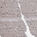 Immunohistochemical staining of human cerebral cortex shows moderate nuclear positivity in neurons.