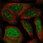 Immunofluorescent staining of human cell line U-2 OS shows localization to nucleoplasm & nuclear bodies.