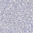 Immunohistochemical staining of human liver shows no nuclear positivity in hepatocytes